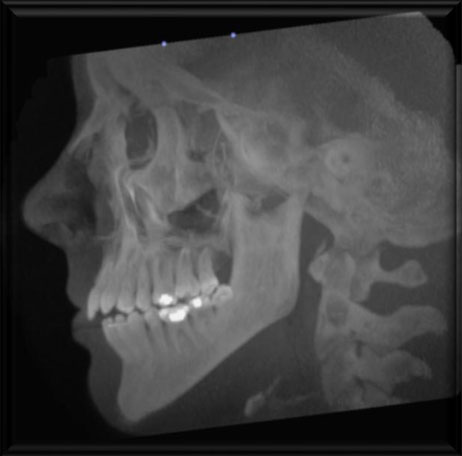 cbct-showing